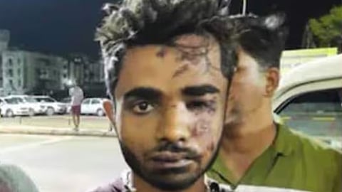 ട്രെയ്ൻ തീവെയ്പ്പ് കേസിലെ പ്രതി ഷാറൂഖ് സെയ്ഫിക്ക് മഞ്ഞപ്പിത്തം