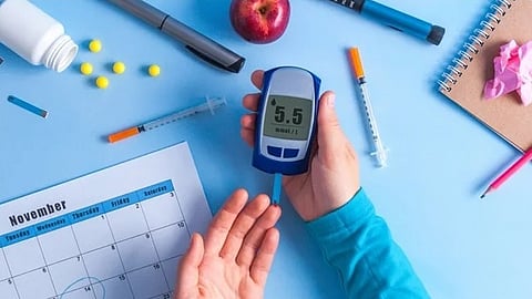 Representative image