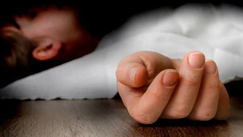 Representative Image