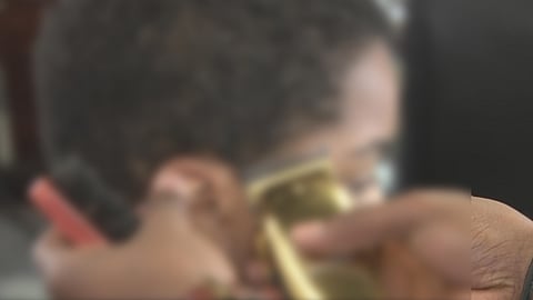 Representative Image