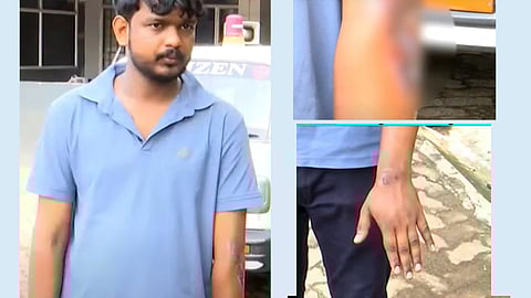 പരിക്കേറ്റ രമേശ്