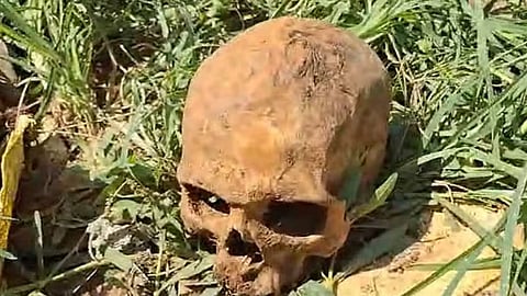 പറമ്പിൽനിന്ന് കണ്ടെത്തിയ തലയോട്ടി