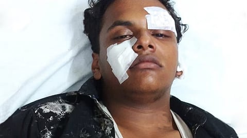 ക്രൂരമർദനം; സഹപാഠികളുടെ ആക്രമണത്തിൽ വിദ്യാർഥിയുടെ നെഞ്ചിൽ കുത്തേറ്റു