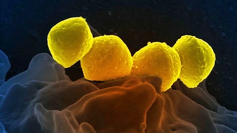 ശരീരത്തിൽ പ്രവേശിച്ചാൽ 48 മണിക്കൂറിനകം മരണം; ജപ്പാനിൽ അപൂർവ ബാക്റ്റീരിയ പടരുന്നു