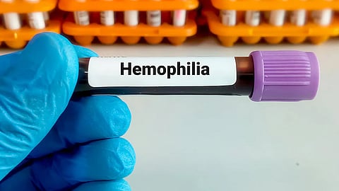 kerala hemophilia treatment childrens