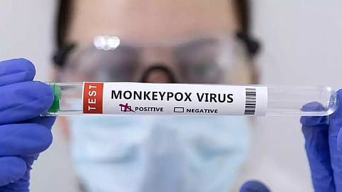 health minister monkeypox vigilance protocol