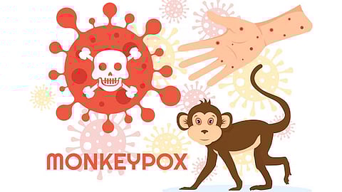 ലോകമെമ്പാടും ഉന്മൂലനം ചെയ്യപ്പെട്ടതായി പ്രഖ്യാപിച്ചിട്ടുള്ള വസൂരിയുടെ ലക്ഷണങ്ങളുമായി എംപോക്സ് ലക്ഷണങ്ങള്ക്ക് സാദൃശ്യമുണ്ട് Mpox - monkeypox explainer precautions
