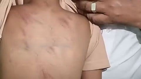 three and half years old baby brouty beaten play school teacher arrested in kochi