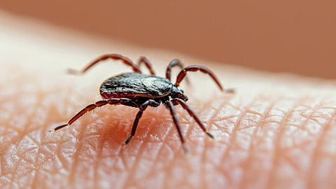 murine typhus confirmed in thiruvananthapuram