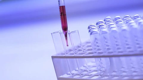 Mysterious neurotoxin disease in Jammu Kashmir