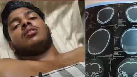 "Go and donate blood, you won't die"; Student brutally beaten for not participating in ABVP's blood donation camp