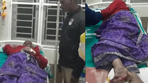 elderly woman was injured in a wild elephant attack