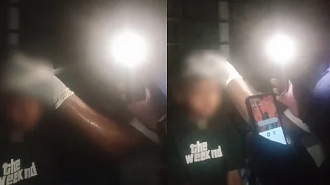 the child was taken to the hospital with a head injury; Stitched in the light of the phone
