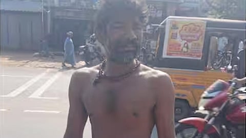 no free meat given; crematorium worker takes away cremated human body