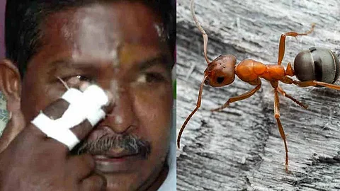 Ants in hospital stitched wound: Patient complains