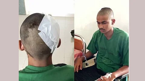 A 17-year-old boy was beaten up while trying to resolve an argument while playing football.