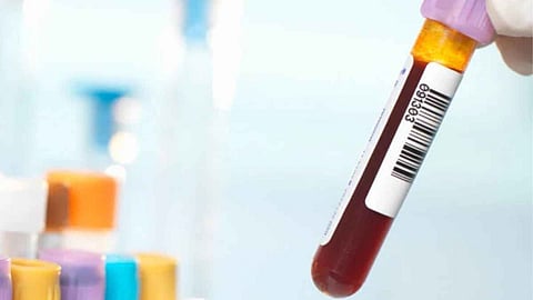 Blood Donation Ban On Gays, Transgender Persons and Sex Workers