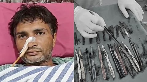 Man addicted to eating spoons and toothbrushes