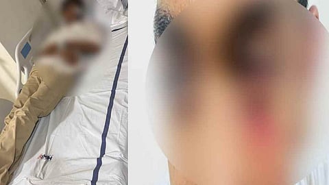 Student beaten during Dufmut training