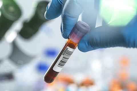 Cancer can be detected ten years in advance through blood test:
American scientists!