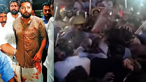 shafi parambil mp lathi charge perambra video