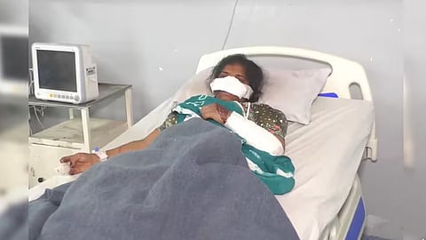 Madhya Pradesh Man Cuts Off Wife's Nose Over Suspected Infidelity