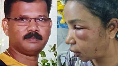 യുവതിക്ക് ക്രൂര മർദനം