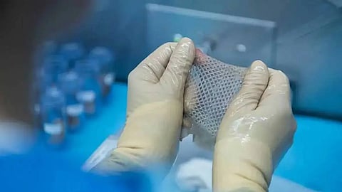 skin bank starts operations