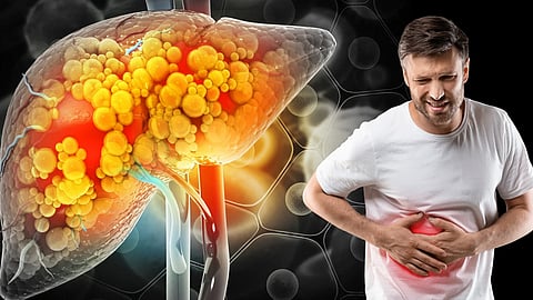 Should you be afraid of fatty liver?