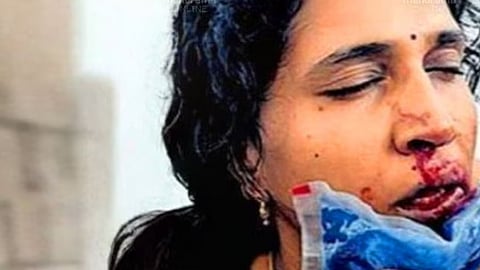 Student slaps teacher on the nose after being warned for playing games in class