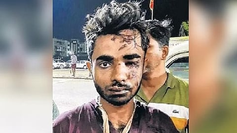 Police gets 11-day custody of train fire suspect, Kerala CM hands over compensation to victims' kin