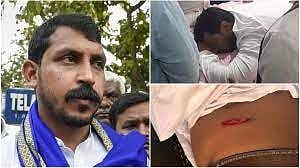 Condition of Bhim Army chief stable, vehicle used by attackers recovered: Police