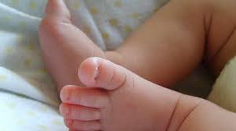 Representative image