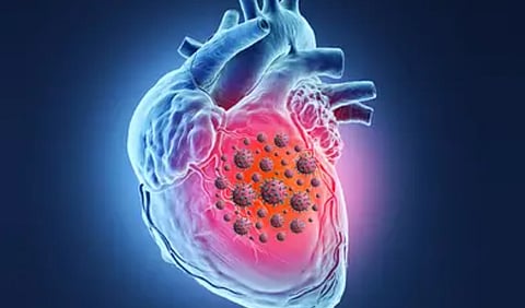 Researchers advise patients to be cautious about heart infections