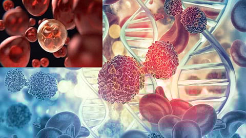 Hybrid nanoparticles of gold and copper sulfide for cancer cell necrosis