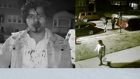 Indian IT student brutally attacked in Chicago