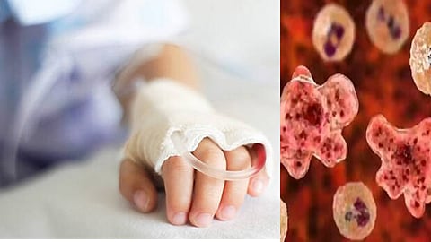 Amoebic meningoencephalitis