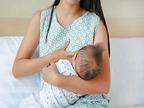 Representative image