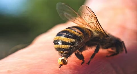 Representative image