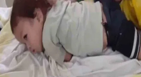 Child bites snake