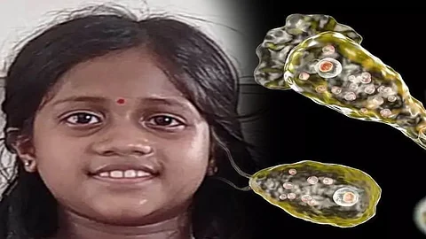 Amoeba found in well water at home