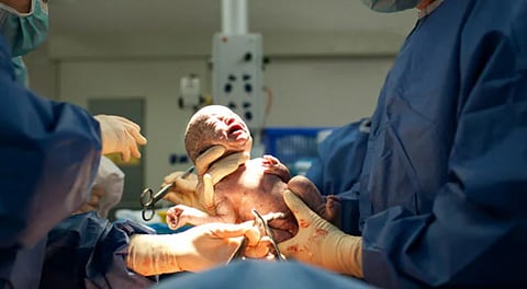 Child birth