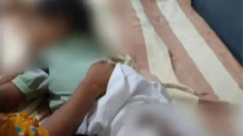 Woman arrested in Kerala for burning son's buttocks