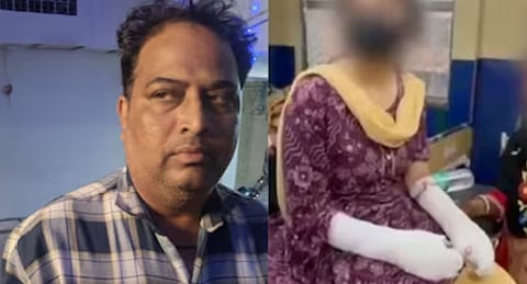 Delhi fake acid attack claim