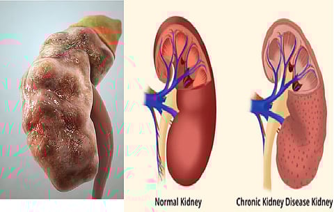 Representative image