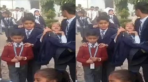 Representative image