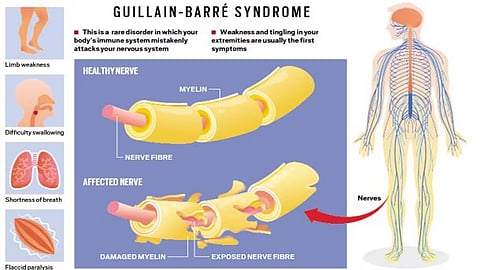 Indore water contamination