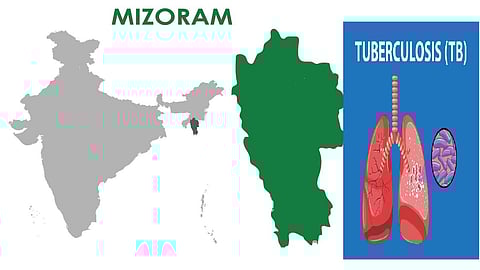 At 145, Mizoram recorded six-year high TB deaths in 2025