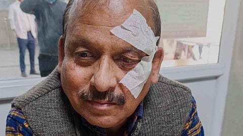 Uttarakhand Director of Elementary Education Ajay Kumar Nautiyal shows injuries he allegedly sustained during an assault by BJP MLA Umesh Sharma Kau and his supporters during a dispute over school renaming at the education directorate, in Dehradun, Saturday, Feb. 21, 2026.