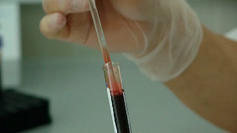 Se recomienda realizar la prueba del VIH tres meses después de que se tuvo el contacto sexual para que ésta tenga un resultado certero